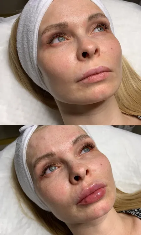 Клиника инновационной косметологии Vallistep фото 12