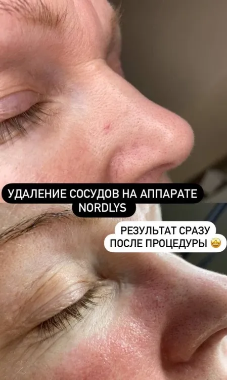 Клиника инновационной косметологии Vallistep Ярославль, улица Лисицына, 57 фото 3