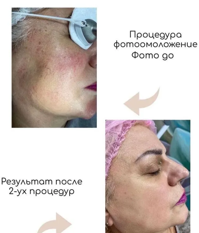 Клиника инновационной косметологии Vallistep фото 6