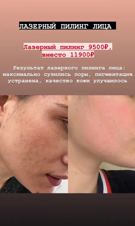 Клиника инновационной косметологии Vallistep фото 9