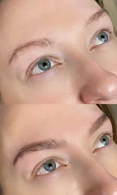 Клиника инновационной косметологии Vallistep фото 11