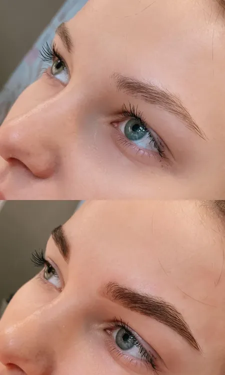 Клиника инновационной косметологии Vallistep фото 7